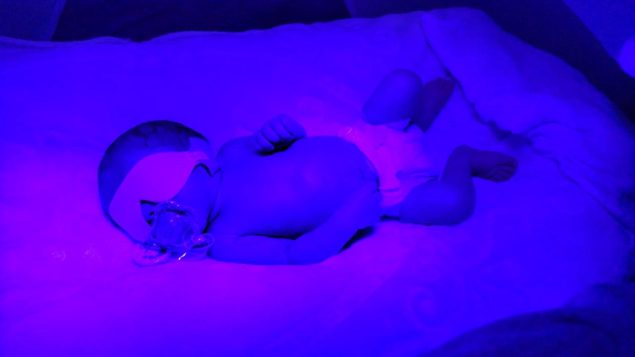 Bebê recém-nascido recebendo tratamento de fototerapia neonatal em casa