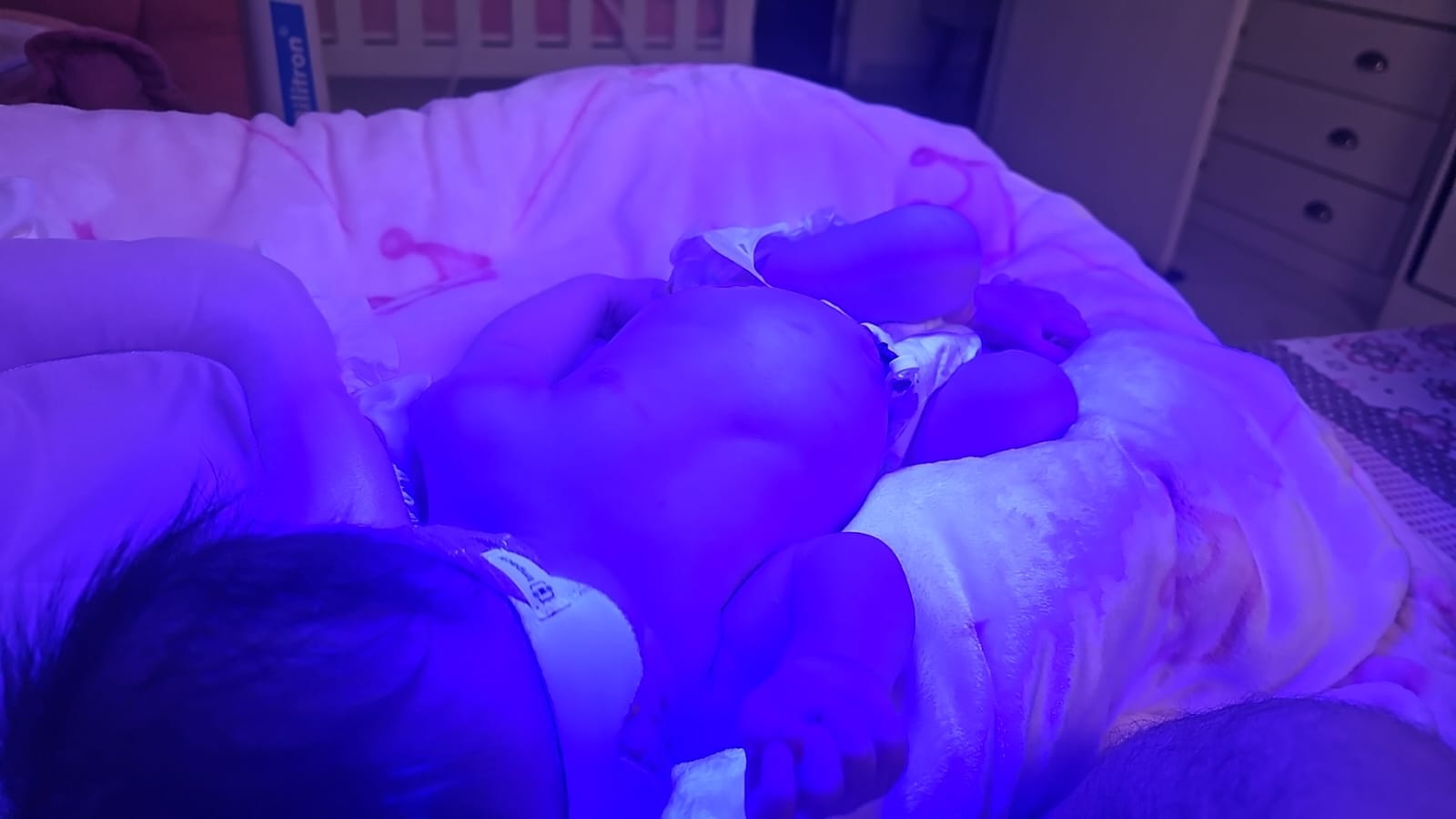 Atendimento humanizado de fototerapia em casa